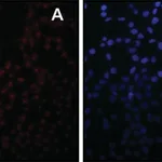 Merck Anti-Sirt7 antibody produced in rabbit