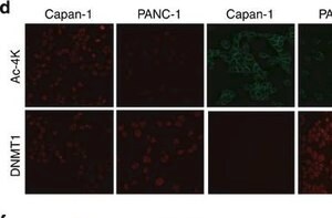 Merck MOUSE MONOCLONAL ANTI-VIMENTIN CLONE V9&