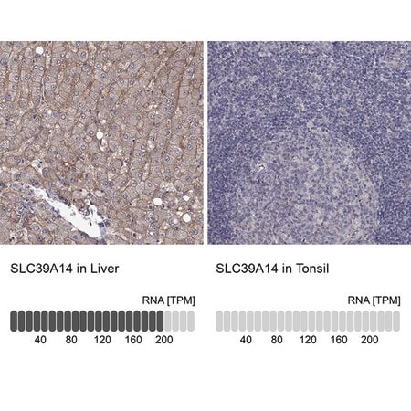 Merck Anti-SLC39A14 antibody produced in rabbit