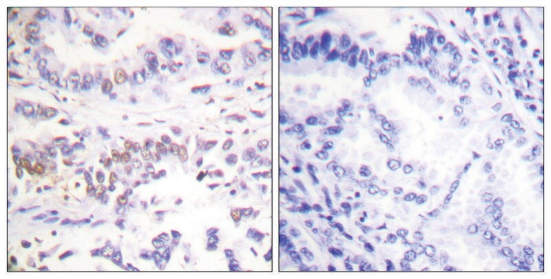 Merck Anti-XRCC3 antibody produced in rabbit
