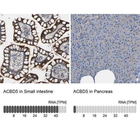 Merck Anti-ACBD5 antibody produced in rabbit