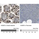 Merck Anti-ACBD5 antibody produced in rabbit