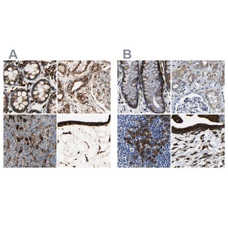 Merck Anti-RRBP1 antibody produced in rabbit