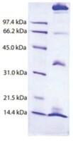 Merck CHYLOMICRONS,HUMAN PLASMA