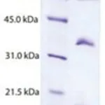 Merck CHYLOMICRONS,HUMAN PLASMA