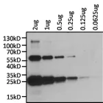 Thermo Fisher Scientific Mouse anti-Human Kappa Light Chain Secondary Antibody, Biotin