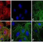 Thermo Fisher Scientific Rabbit anti-Rat IgG (H+L) Secondary Antibody, TRITC