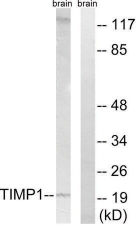 Merck Anti-TIMP1 antibody produced in rabbit