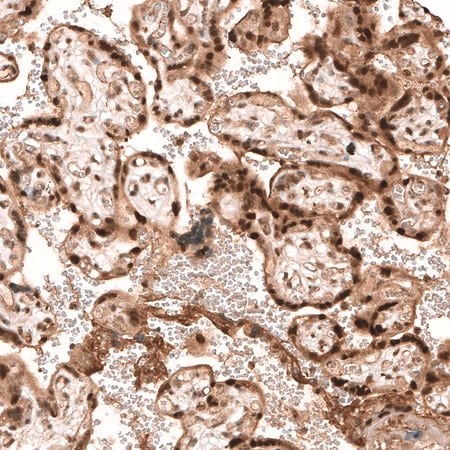 Merck Anti-PARP14 antibody produced in rabbit