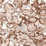 Merck Anti-PARP14 antibody produced in rabbit