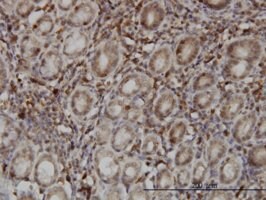 Merck MONOCLONAL ANTI-SENP6