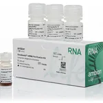 Thermo Fisher Scientific Dynabeads mRNA Purification Kit (for mRNA purification from total RNA preps)