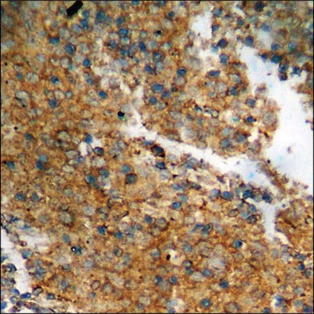 Merck Anti-phospho-Catenin-beta (pThr41/Ser45) antibody produced in rabbit
