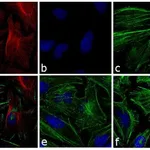 Thermo Fisher Scientific Donkey anti-Mouse IgG (H+L) Highly Cross-Adsorbed Secondary Antibody, Alexa Fluor 568