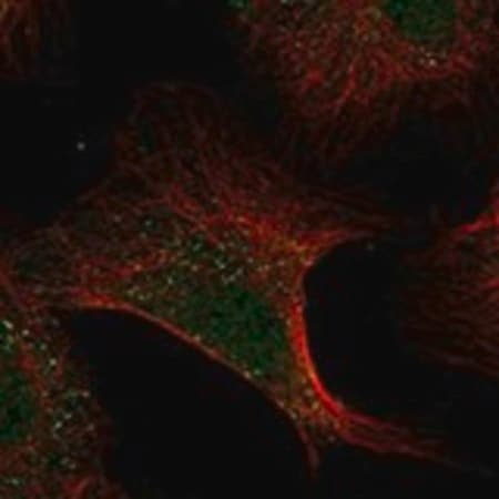 Merck Anti-ADAMTS13 antibody produced in rabbit