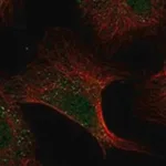 Merck Anti-ADAMTS13 antibody produced in rabbit