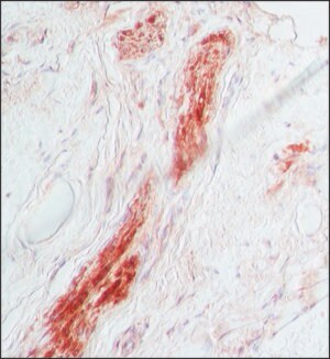 Merck ANTI-S-100, DEVELOPED IN RABBIT