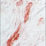 Merck ANTI-S-100, DEVELOPED IN RABBIT