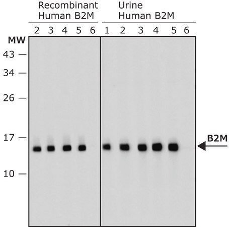 Merck Anti-B2M antibody, Mouse monoclonal