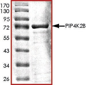 Merck PIP4K2B, ACTIVE