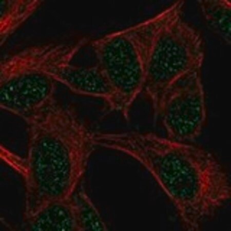 Merck Anti-FANCF antibody produced in rabbit