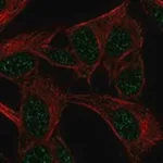Merck Anti-FANCF antibody produced in rabbit