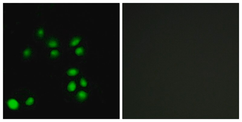 Merck Anti-EXO1 antibody produced in rabbit