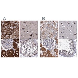 Merck ANTI-CLPB