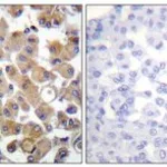Merck ANTI-TGF BETA1 ANTIBODY PROD IN RABB