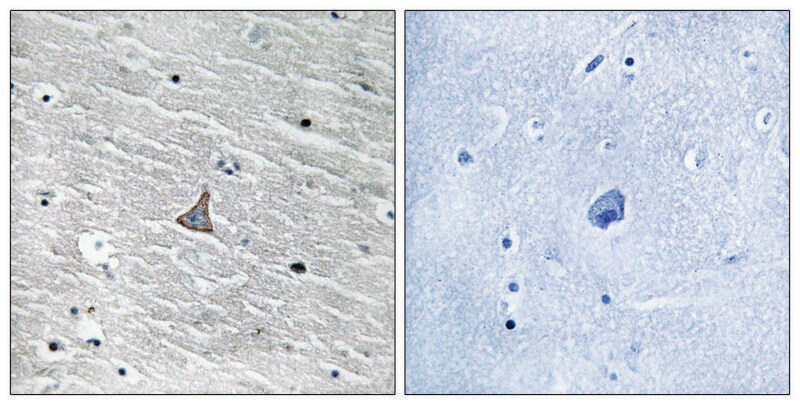 Merck Anti-VHL antibody produced in rabbit