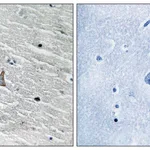 Merck Anti-VHL antibody produced in rabbit
