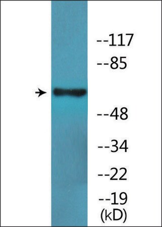 Merck Anti-phospho-SLP-76 (pTyr128) antibody produced in rabbit