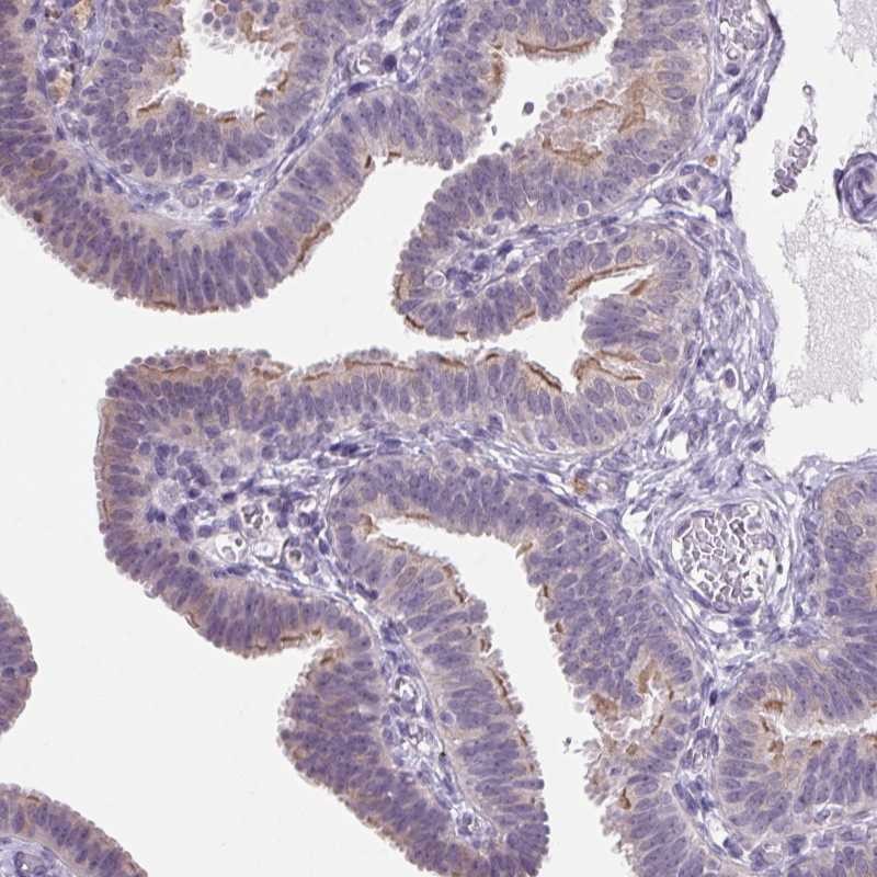 Atlas Antibodies Anti-VWA3B Antibody