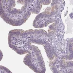 Atlas Antibodies Anti-VWA3B Antibody