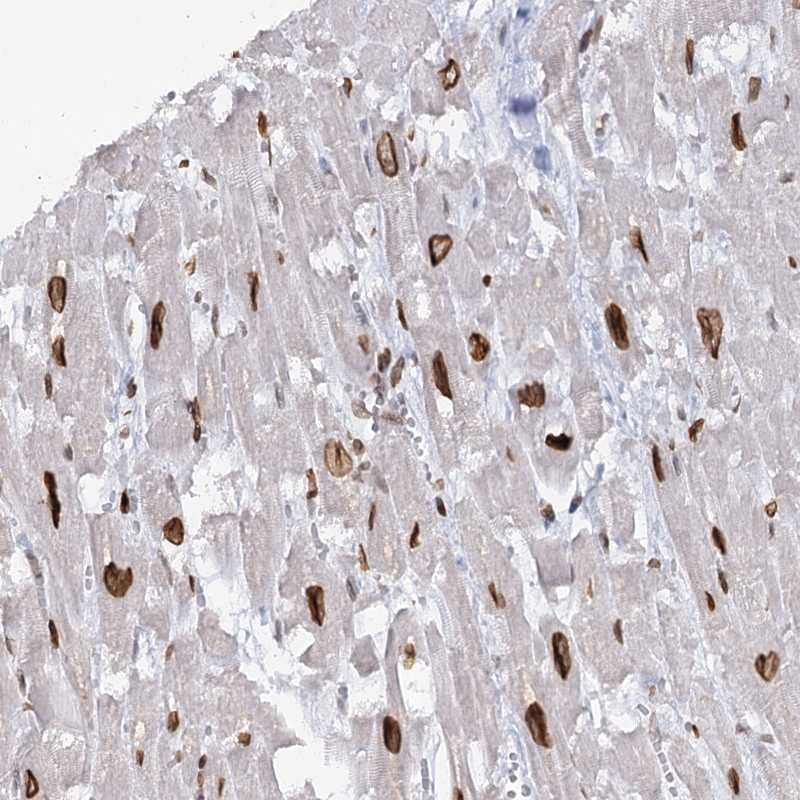 Atlas Antibodies Anti-VWA5A Antibody