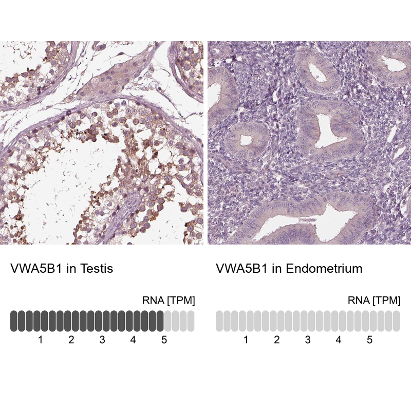 Atlas Antibodies Anti-VWA5B1 Antibody