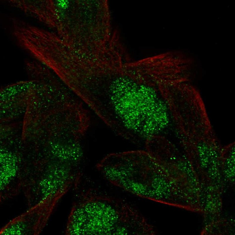 Atlas Antibodies Anti-VWA5A Antibody