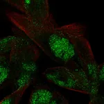 Atlas Antibodies Anti-VWA5A Antibody