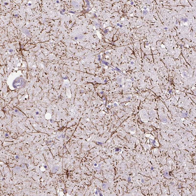 Atlas Antibodies Anti-VWA7 Antibody
