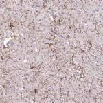 Atlas Antibodies Anti-VWA7 Antibody