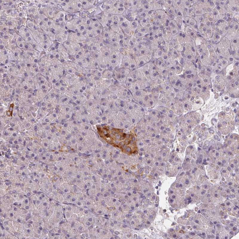 Atlas Antibodies Anti-VWA5B2 Antibody