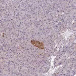 Atlas Antibodies Anti-VWA5B2 Antibody