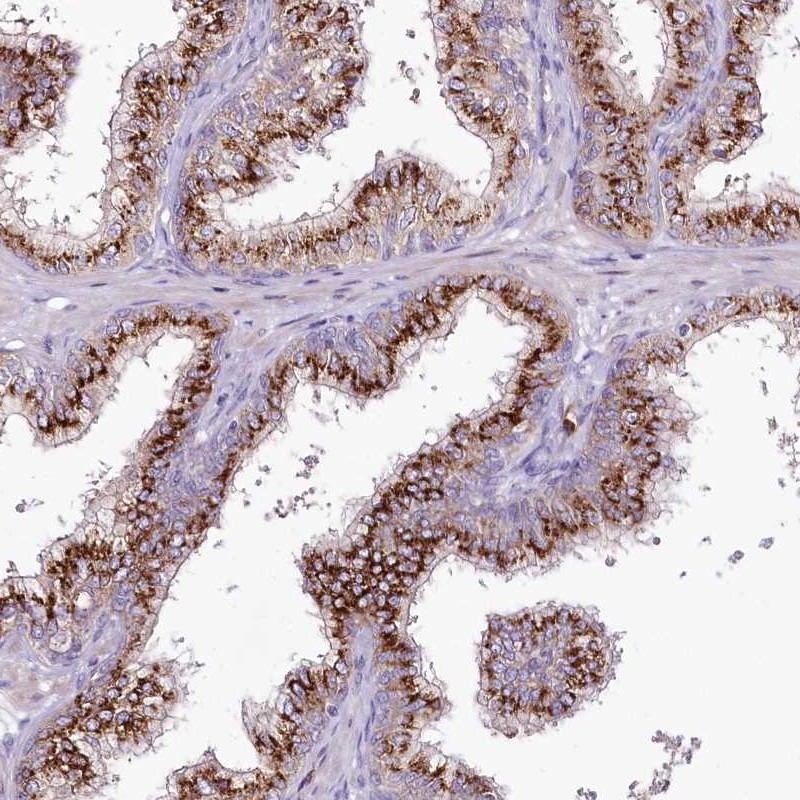 Atlas Antibodies Anti-VWA5A Antibody