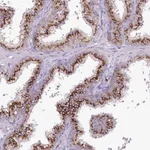 Atlas Antibodies Anti-VWA5A Antibody