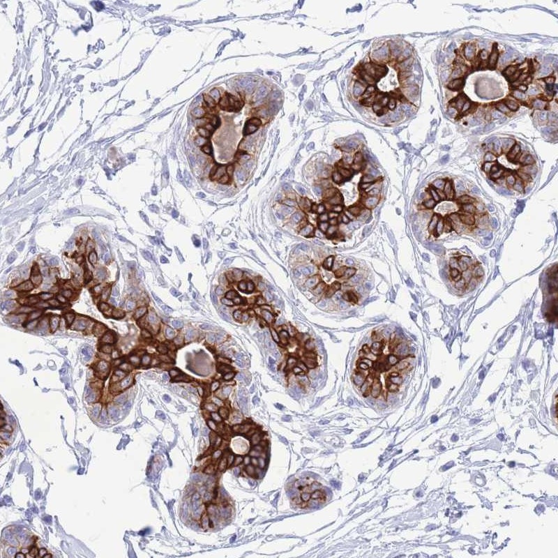 Atlas Antibodies Anti-VWA8 Antibody