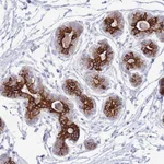 Atlas Antibodies Anti-VWA8 Antibody
