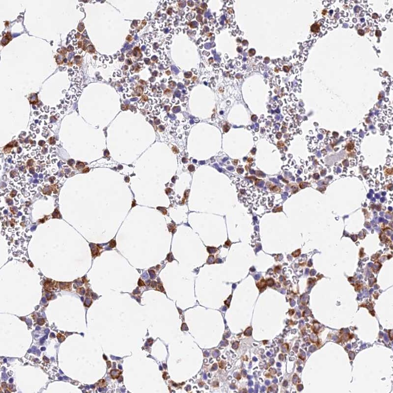 Atlas Antibodies Anti-VWC2L Antibody
