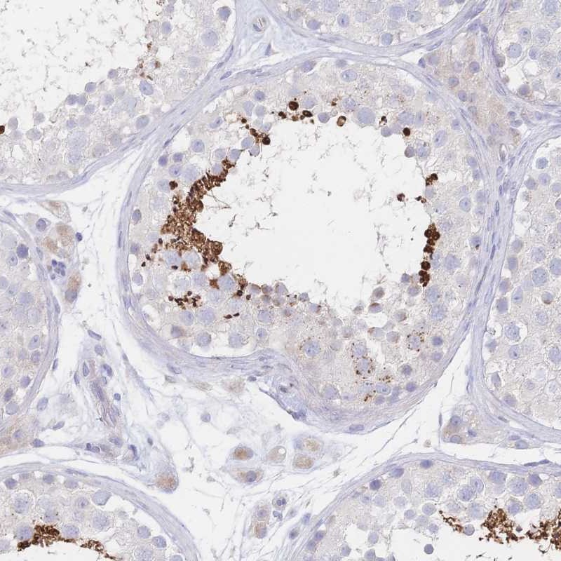 Atlas Antibodies Anti-VWC2L Antibody