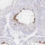 Atlas Antibodies Anti-VWC2L Antibody
