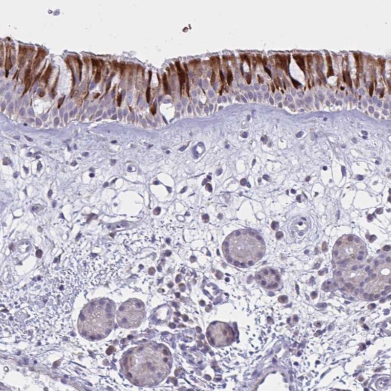 Atlas Antibodies Anti-VWC2 Antibody